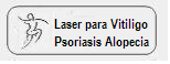 venta de laser para vitiligo psoriasis alopecia